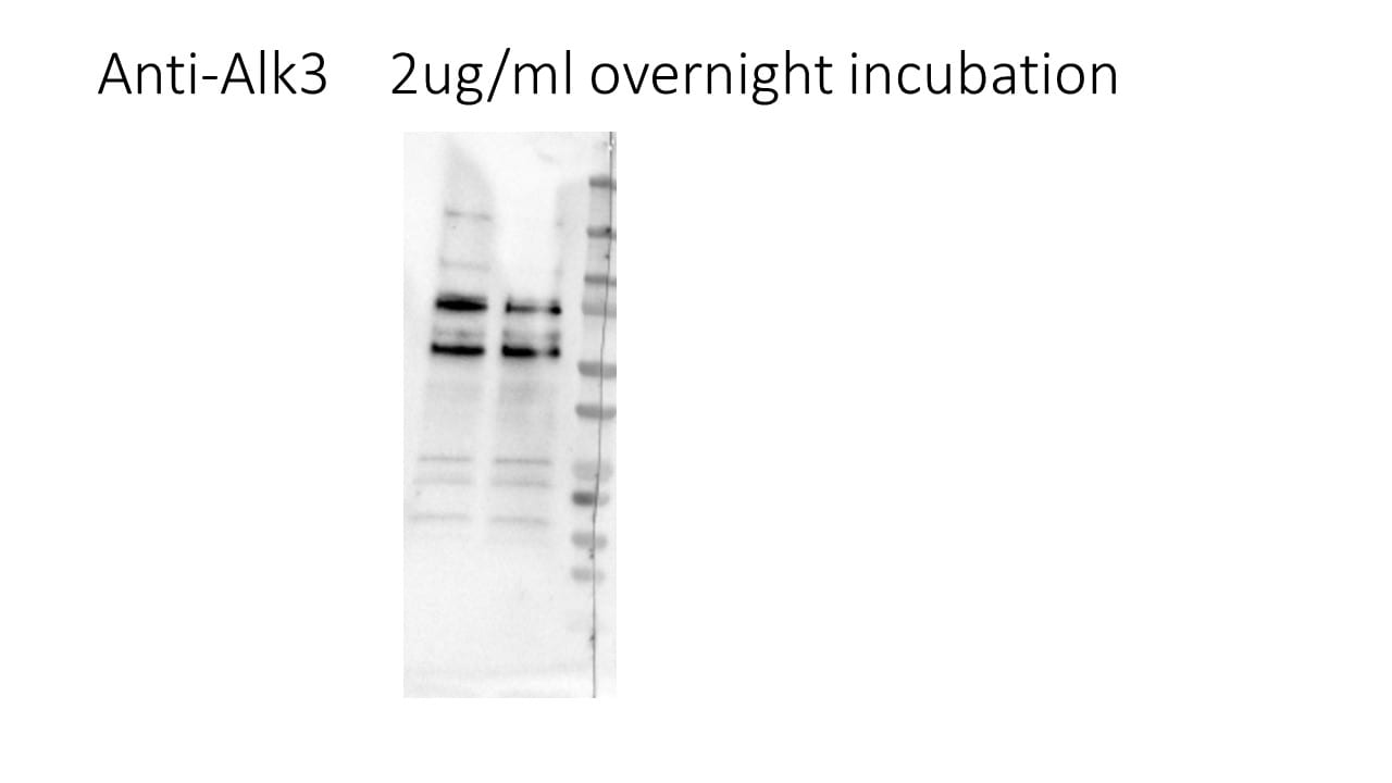 Human BMPR‑IA/ALK‑3 Antibody AF346