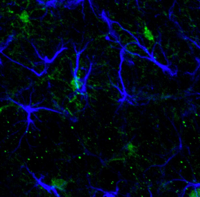 Mouse Galectin‑9 Antibody AF3535