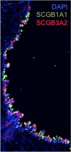 Human UGRP1/SCGB3A2 Antibody AF3545