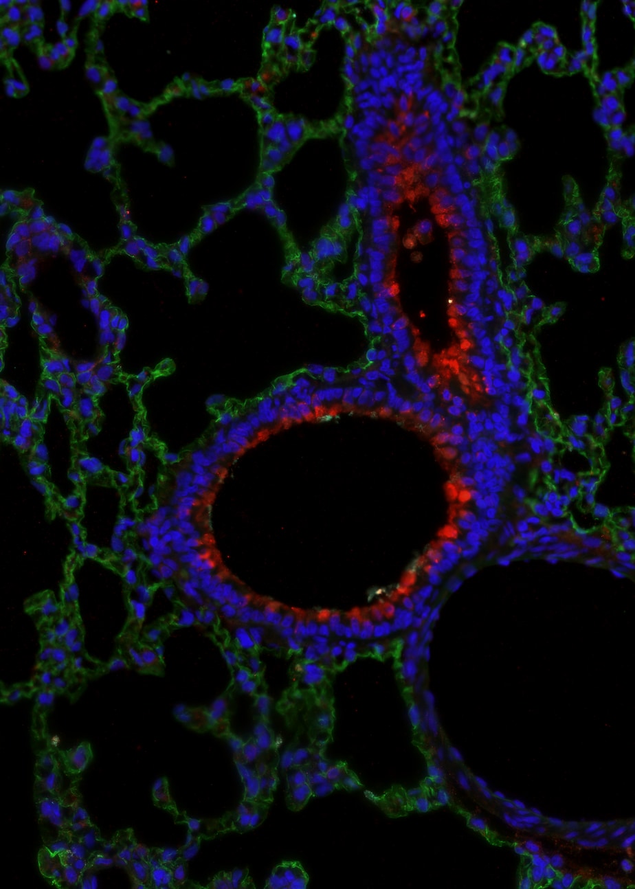 Human UGRP1/SCGB3A2 Antibody AF3545