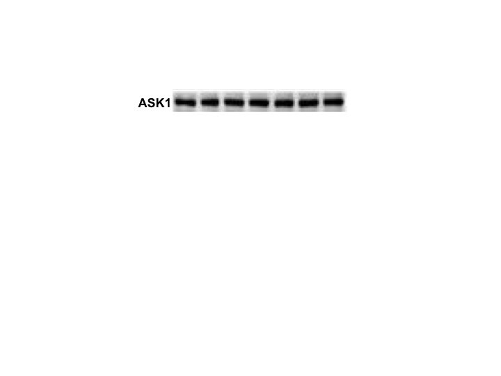Human ASK1 Antibody AF3575