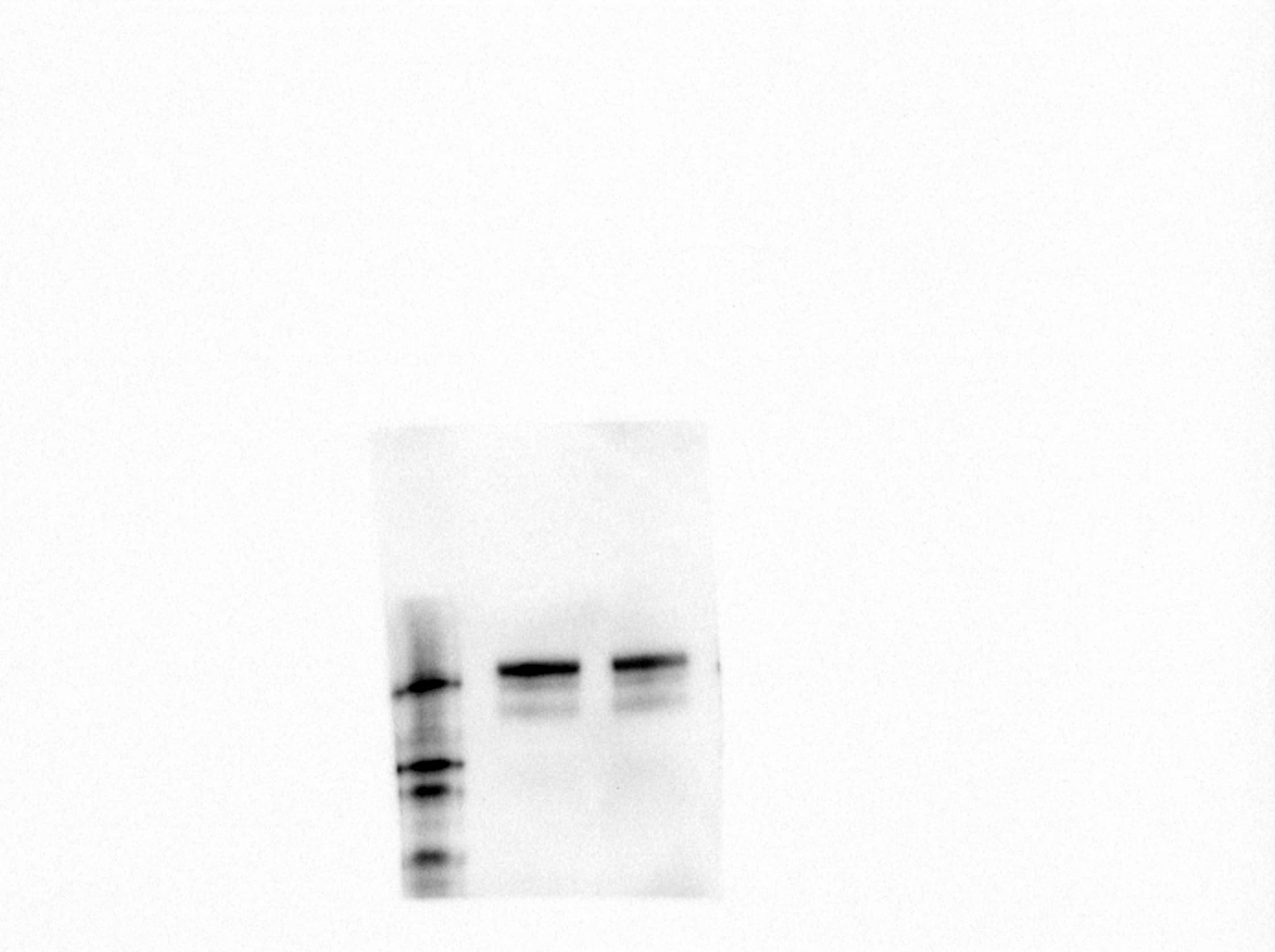Human VEGFR2/KDR/Flk-1 Antibody AF357