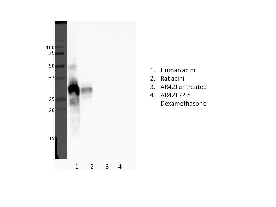 Human Trypsin Pan Specific (PRSS1/2/3) Antibody AF3586
