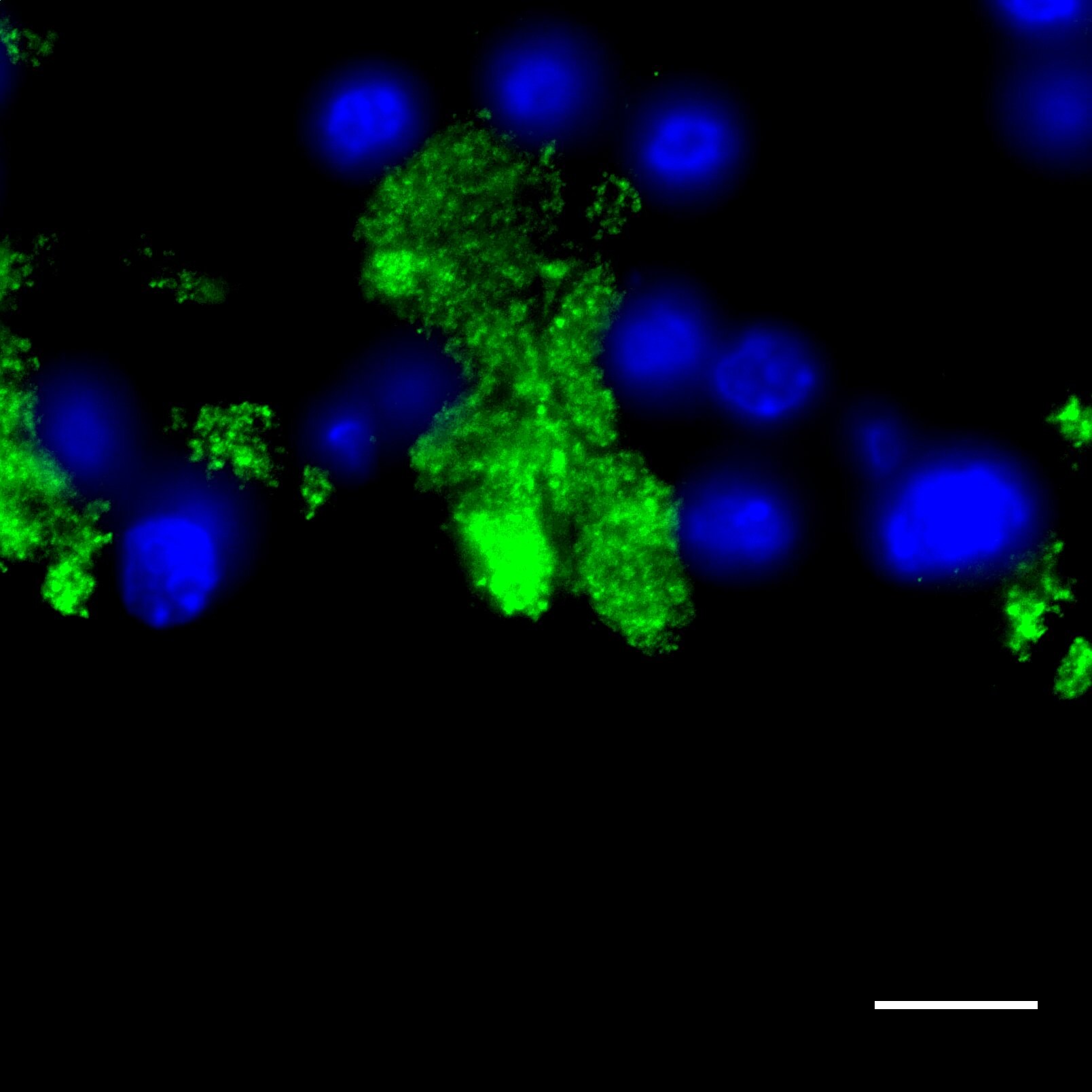 Human Trypsin Pan Specific (PRSS1/2/3) Antibody AF3586