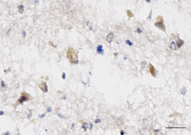 Human IL‑33 Antibody AF3625