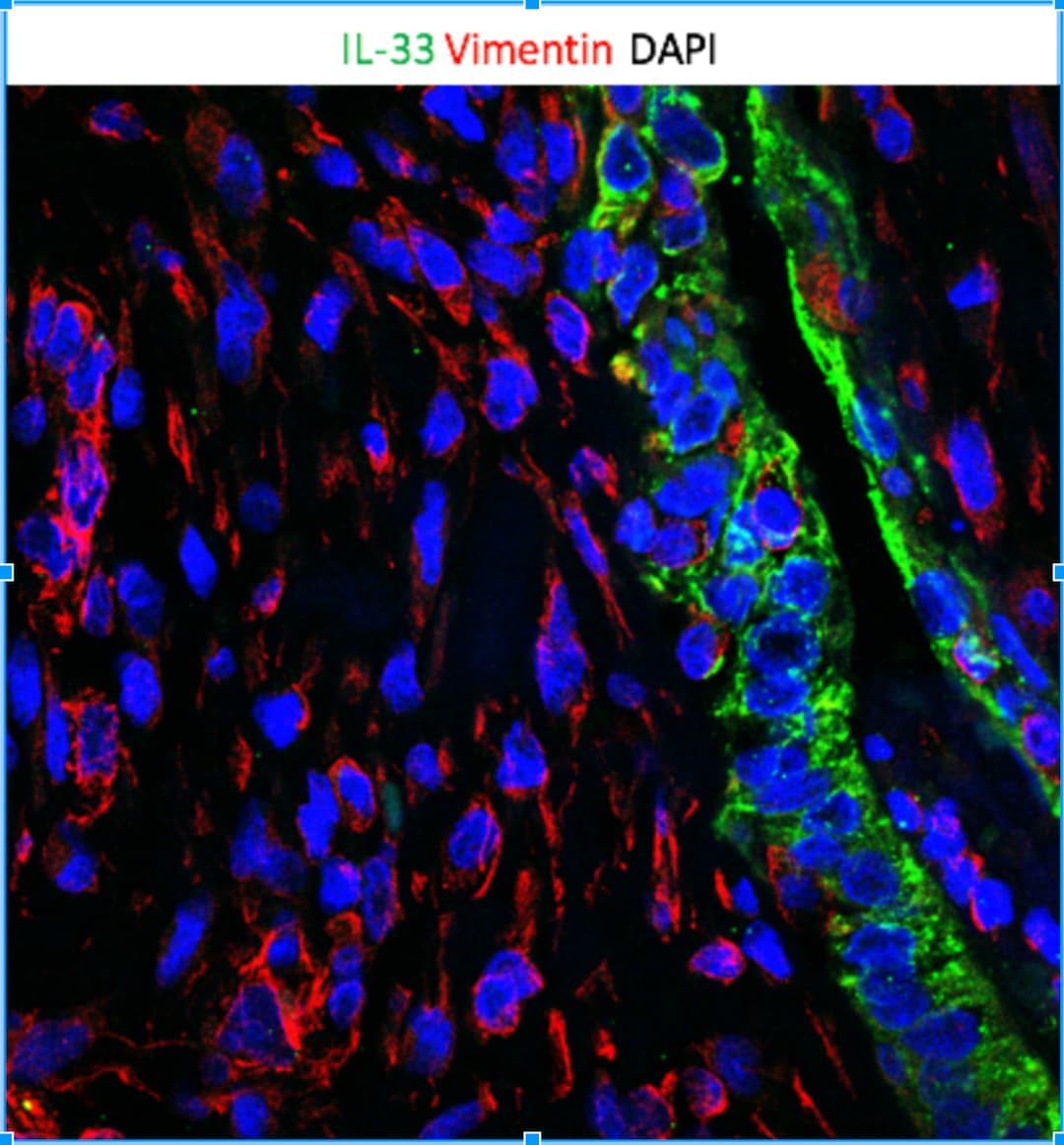 Human IL‑33 Antibody AF3625