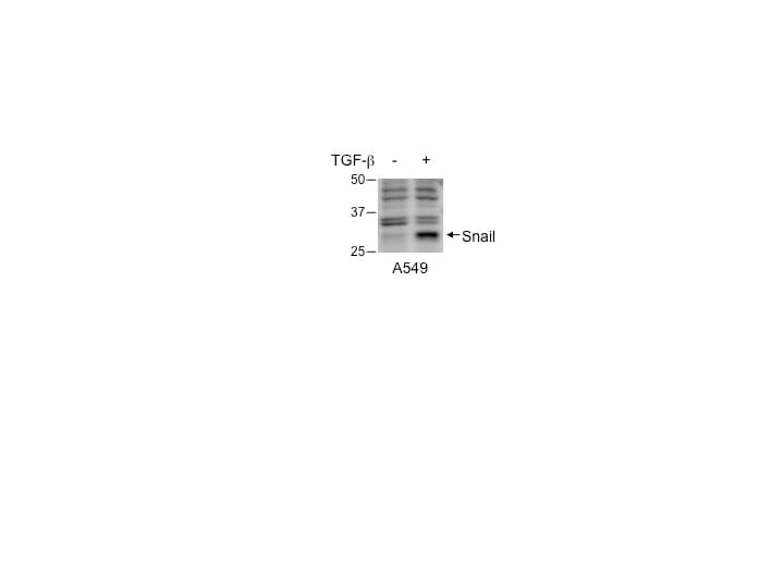 Human Snail Antibody AF3639