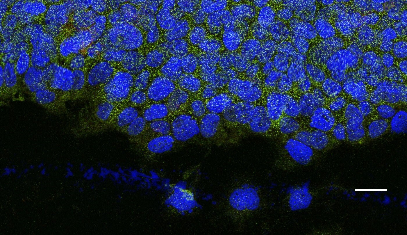 Human Notch‑1 Intracellular Domain Antibody AF3647