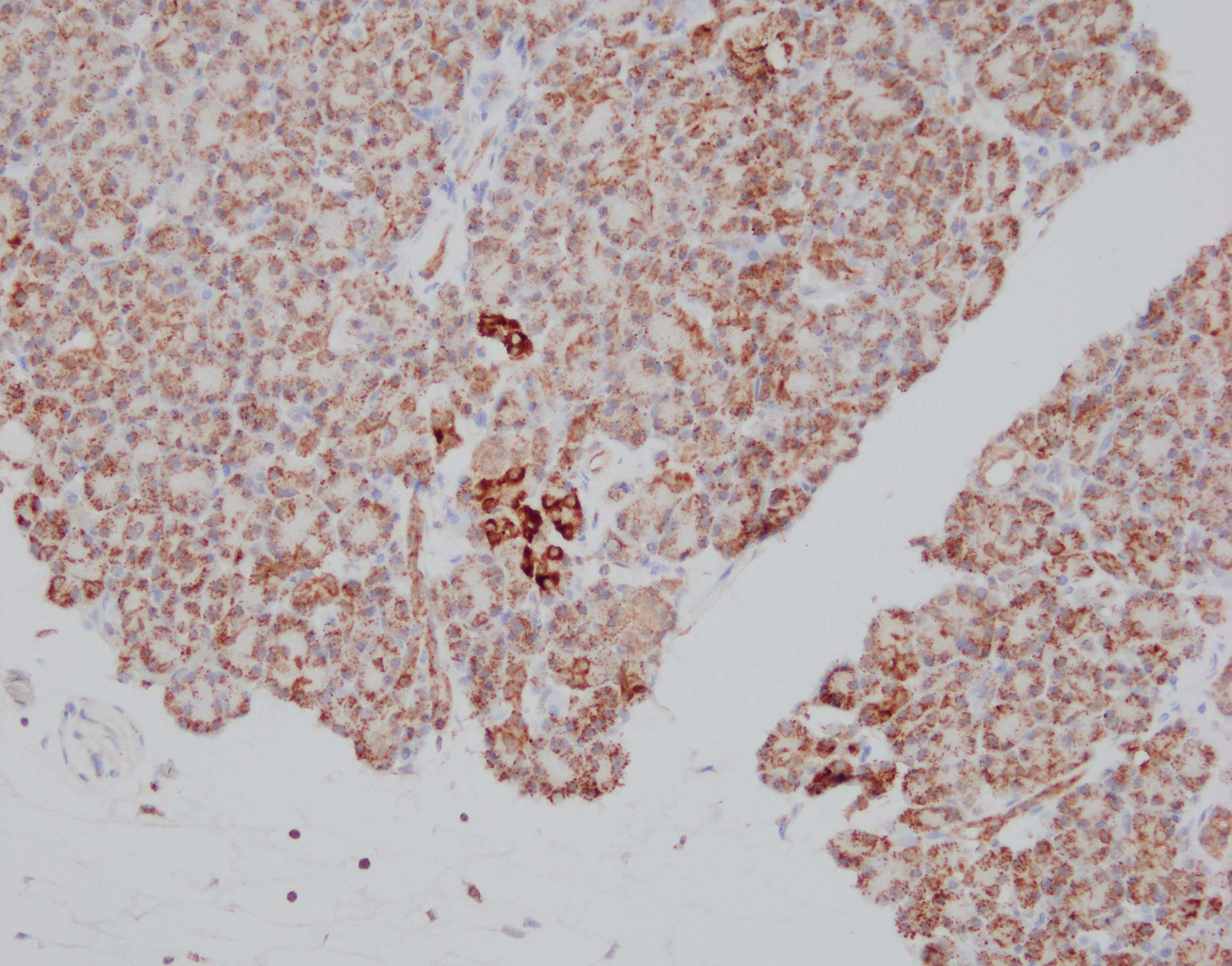 Human CX3CL1/Fractalkine Chemokine Domain Antibody AF365