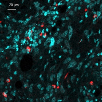 Human/Mouse Myeloperoxidase/MPO Antibody AF3667