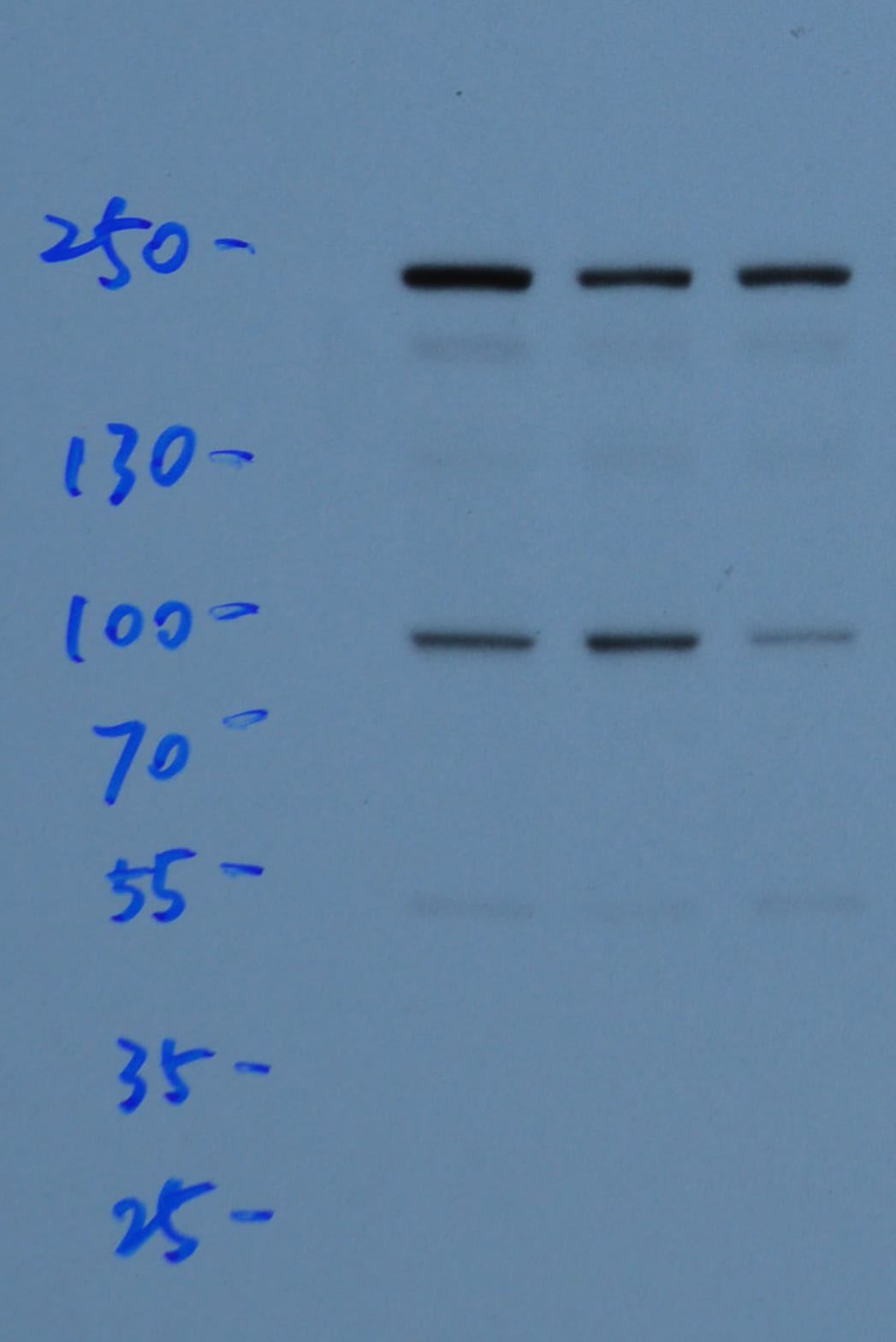 Human/Mouse GLI‑3 Antibody AF3690