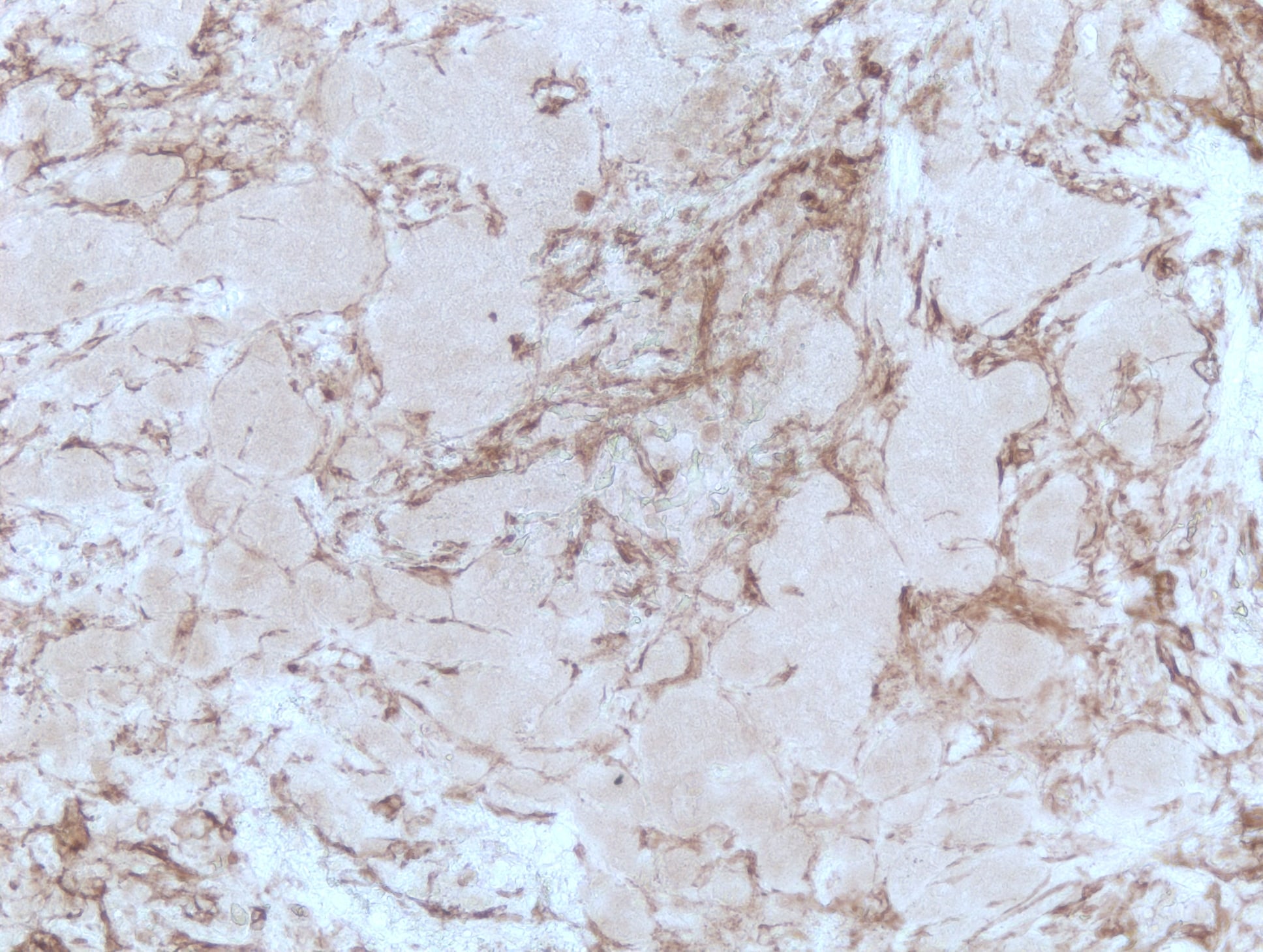 Human Fibroblast Activation Protein  alpha /FAP Antibody AF3715