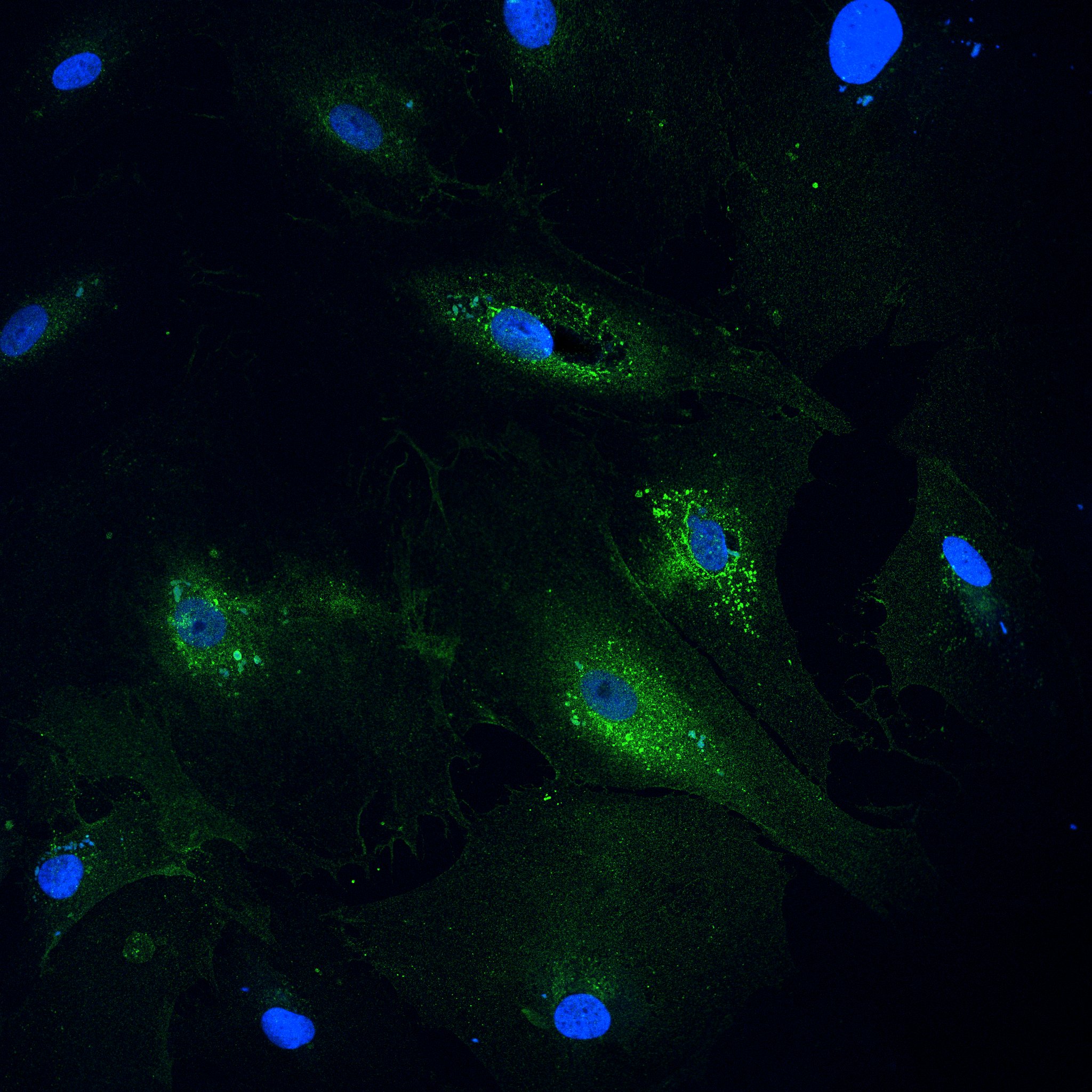 Human Fibroblast Activation Protein  alpha /FAP Antibody AF3715