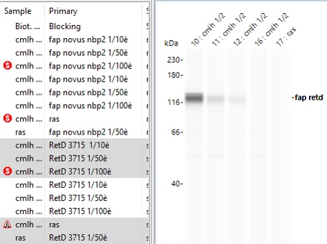 Human Fibroblast Activation Protein  alpha /FAP Antibody AF3715