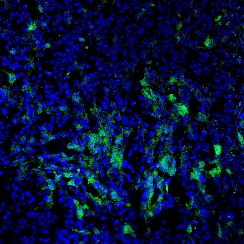 Human Fibroblast Activation Protein  alpha /FAP Antibody AF3715