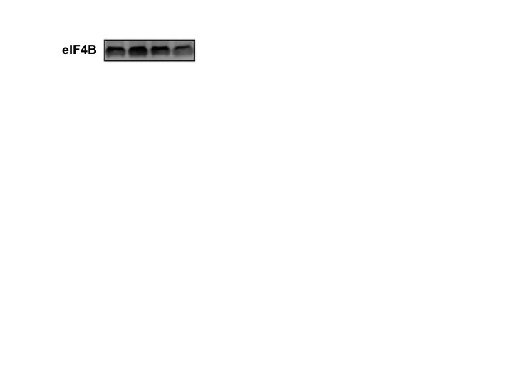 Human eIF4B Antibody AF3800