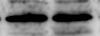 Human PLK1 Antibody AF3804