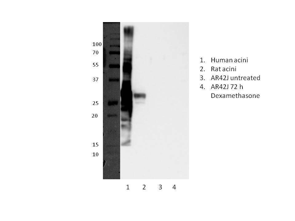 Human Trypsin 1/PRSS1 Antibody AF3848