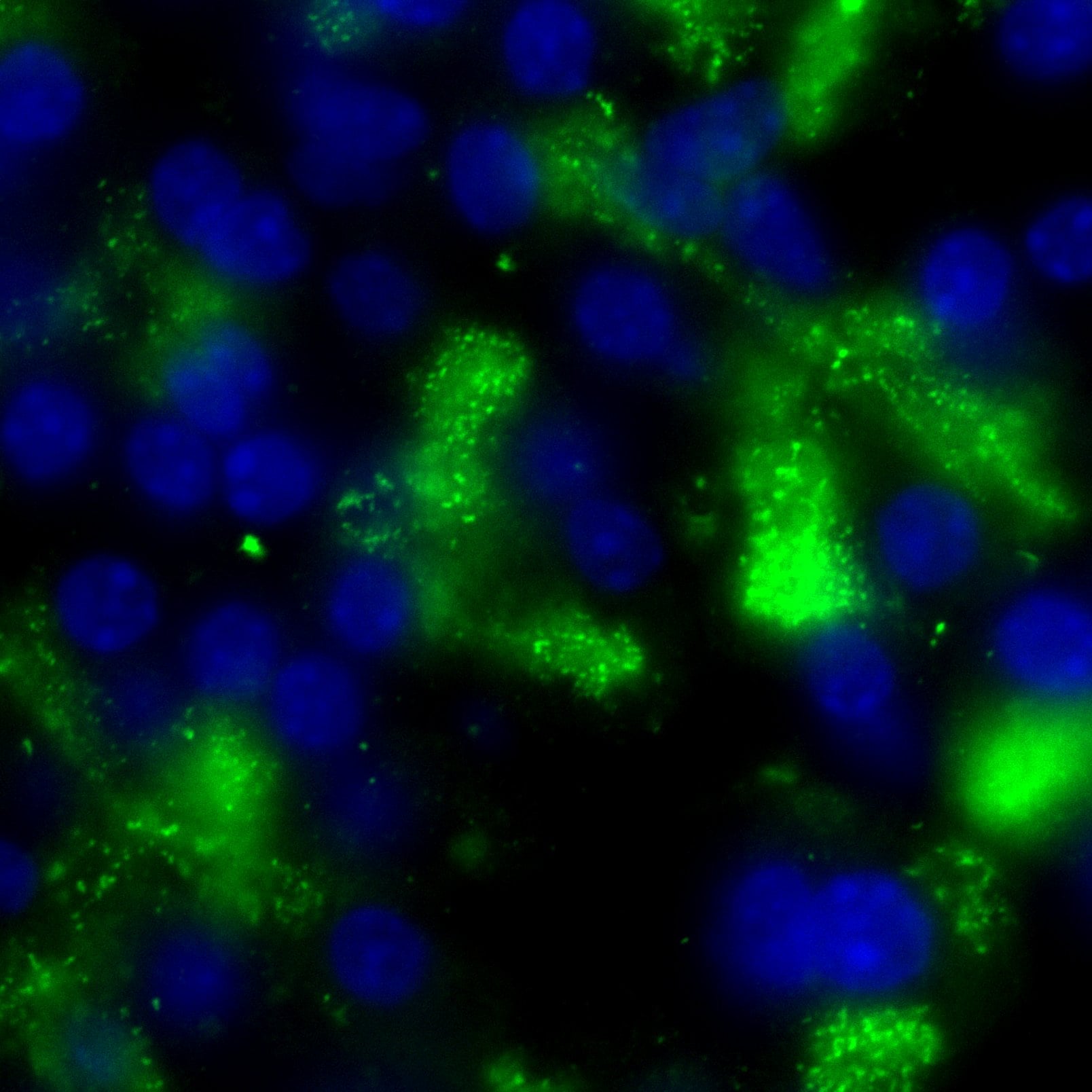 Human Trypsin 1/PRSS1 Antibody AF3848