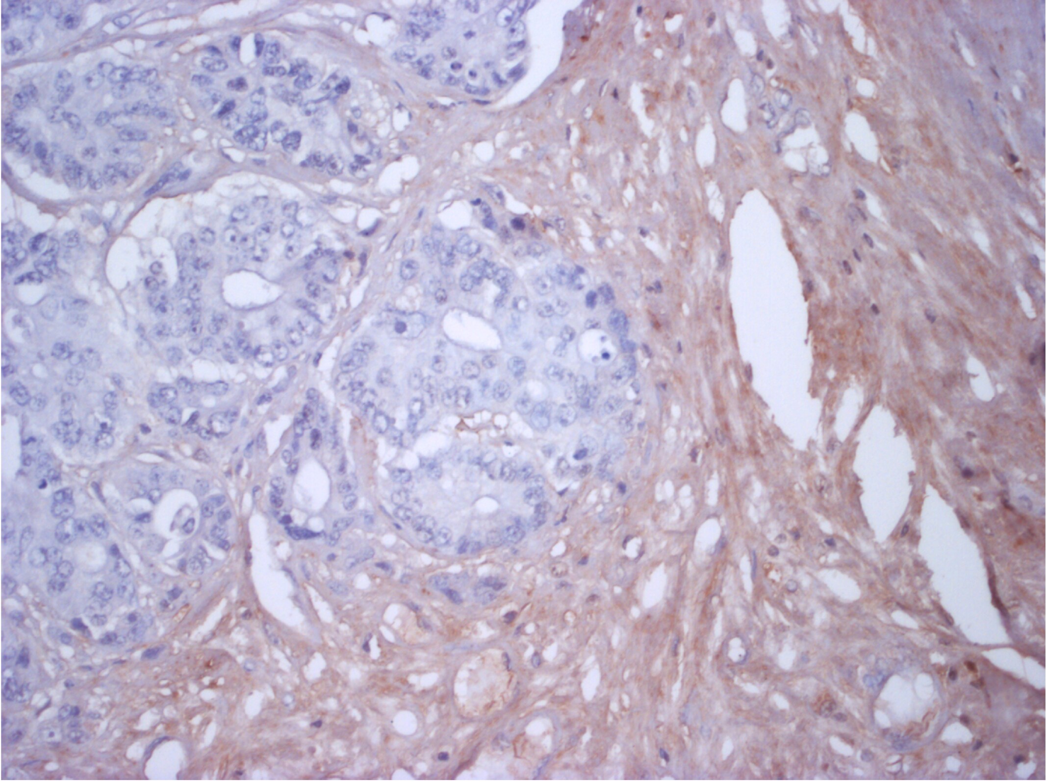 Human Latent TGF‑ beta  bp2/LTBP‑2 Antibody AF3850