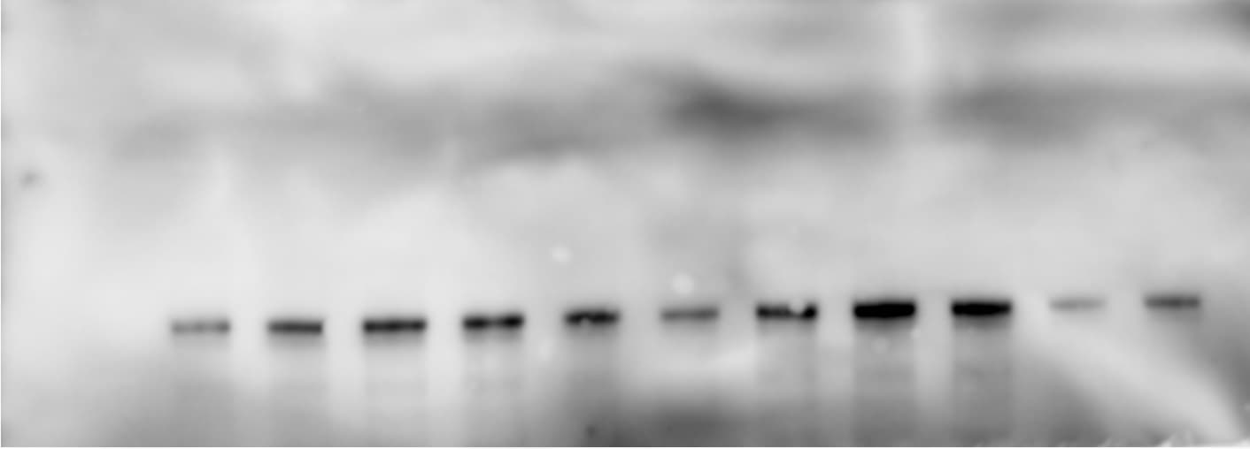 Human PDGF R beta  Antibody AF385