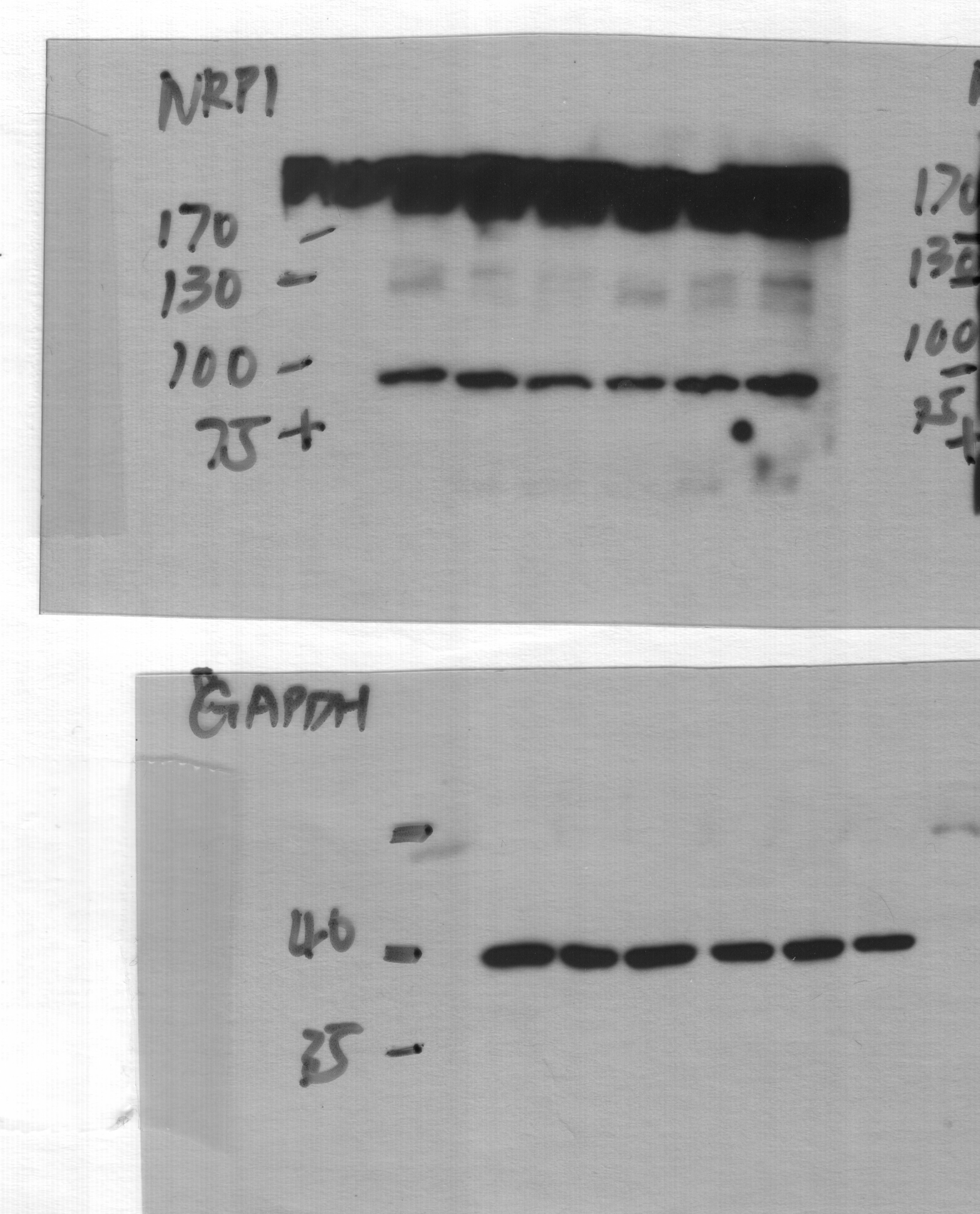 Human Neuropilin‑1 Antibody AF3870