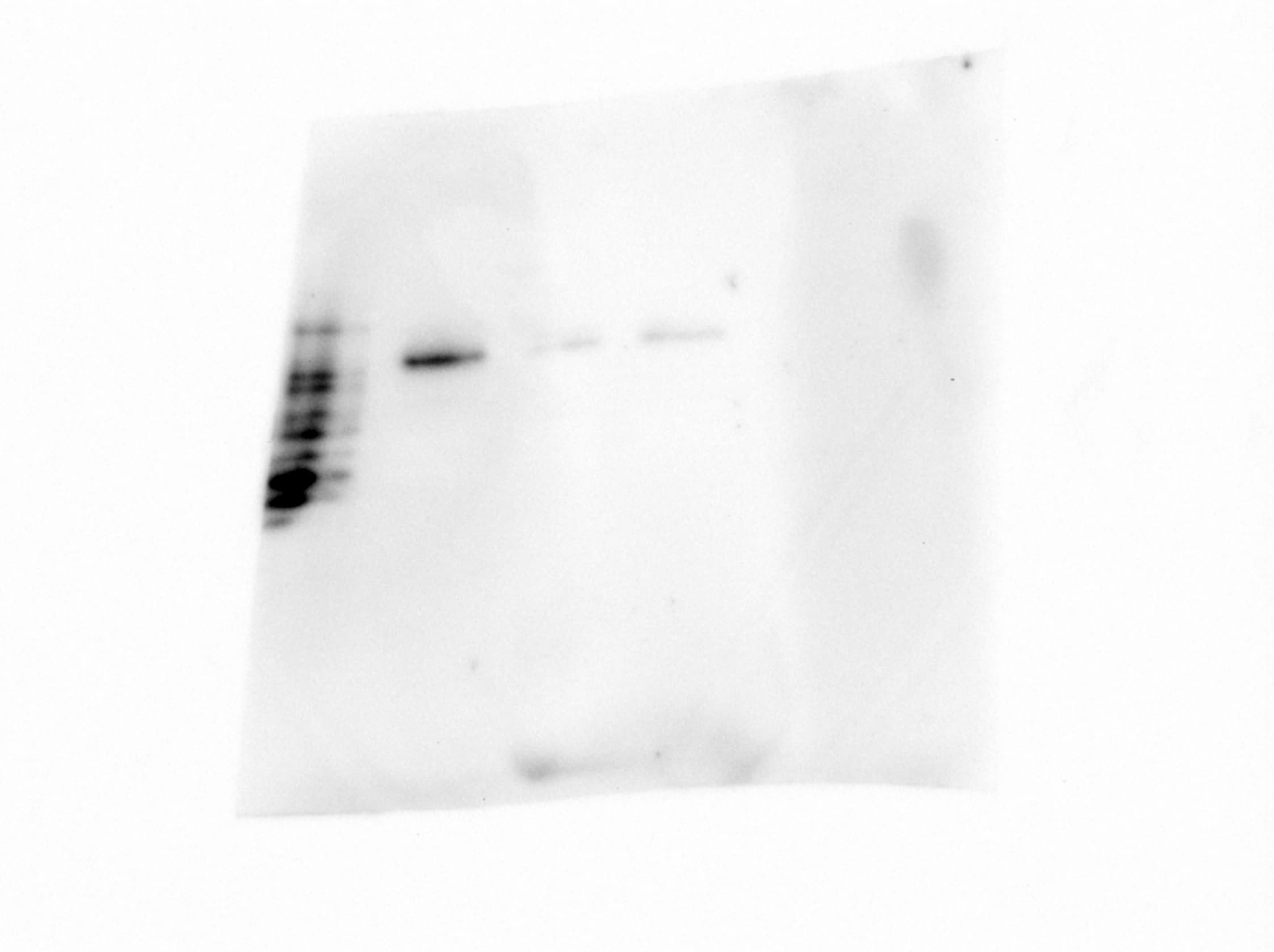 Human Neuropilin‑1 Antibody AF3870