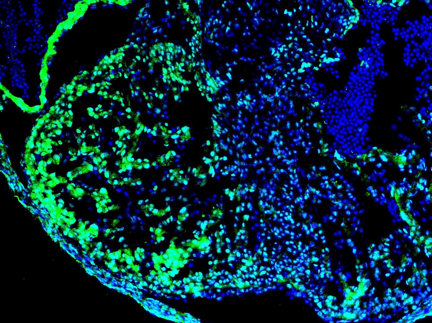 Human/Mouse HAND2 Antibody AF3876