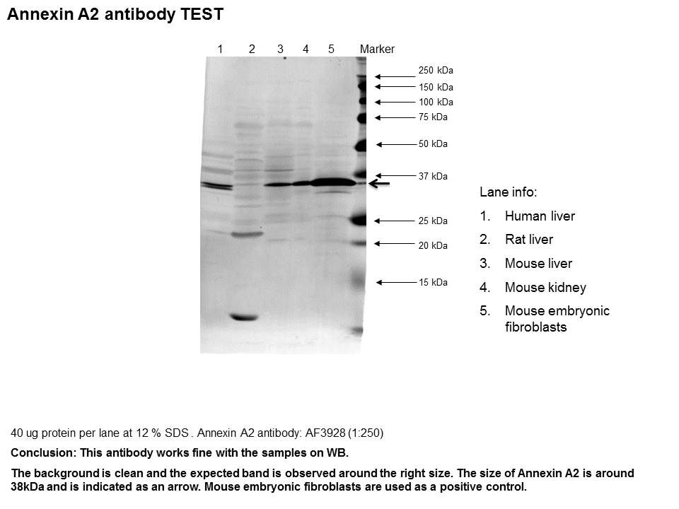 Human/Mouse/Rat Annexin A2 Antibody AF3928