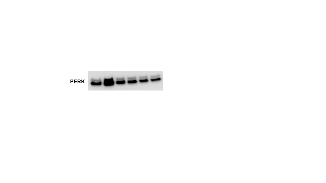 Human PERK Antibody AF3999