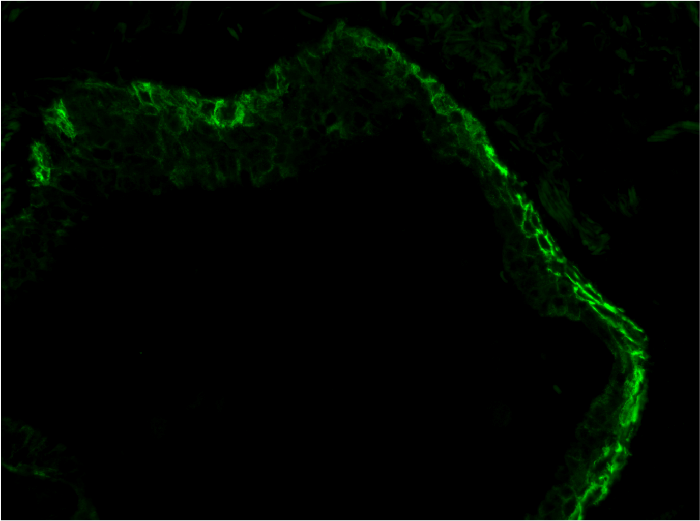 Human Integrin  beta 6 Antibody AF4155