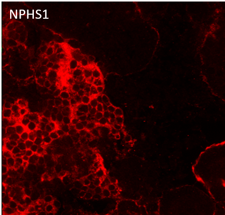 Human Nephrin Antibody AF4269