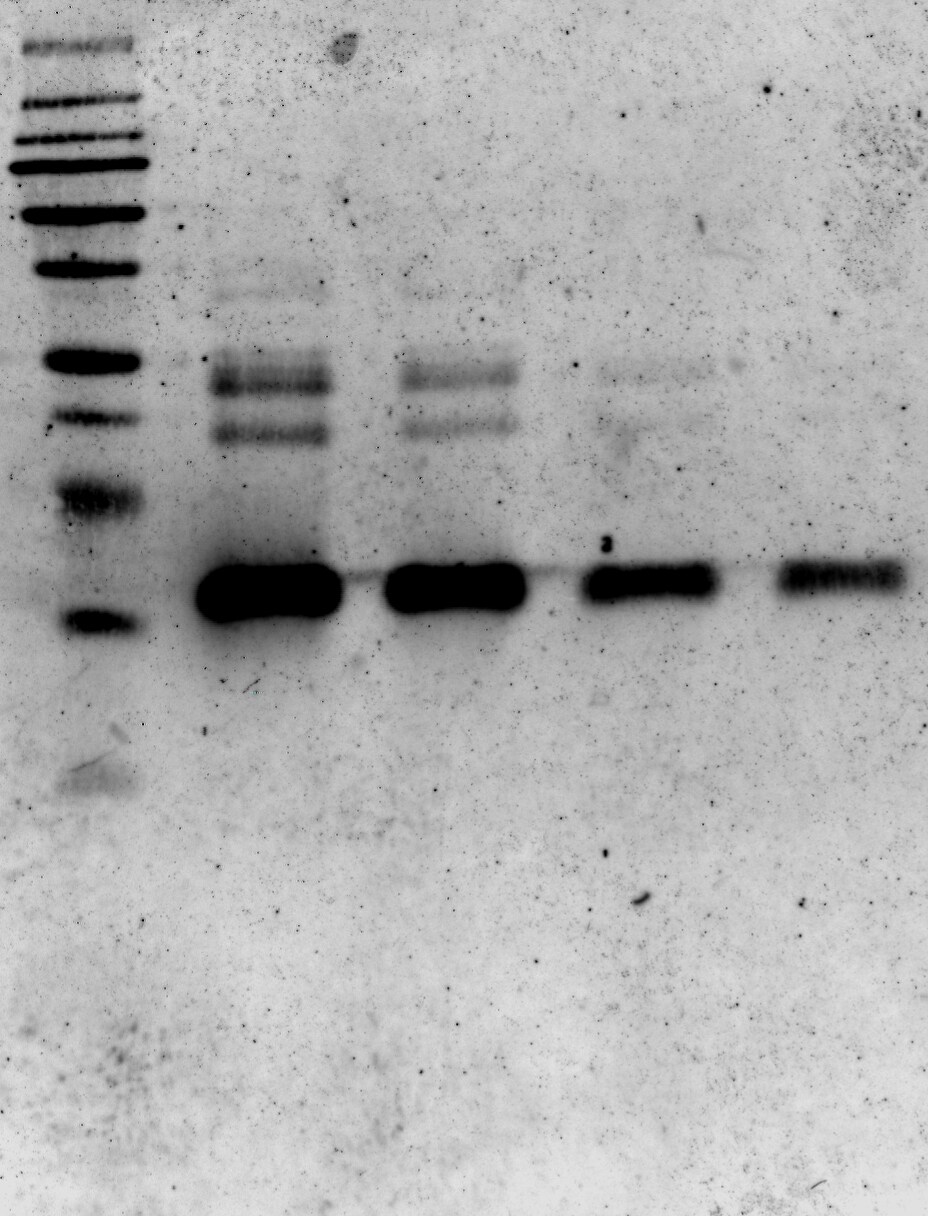 Human S100A8 Antibody AF4570