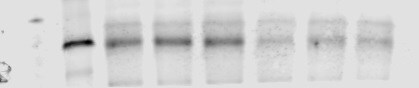 Mouse Osteoprotegerin/TNFRSF11B Antibody AF459
