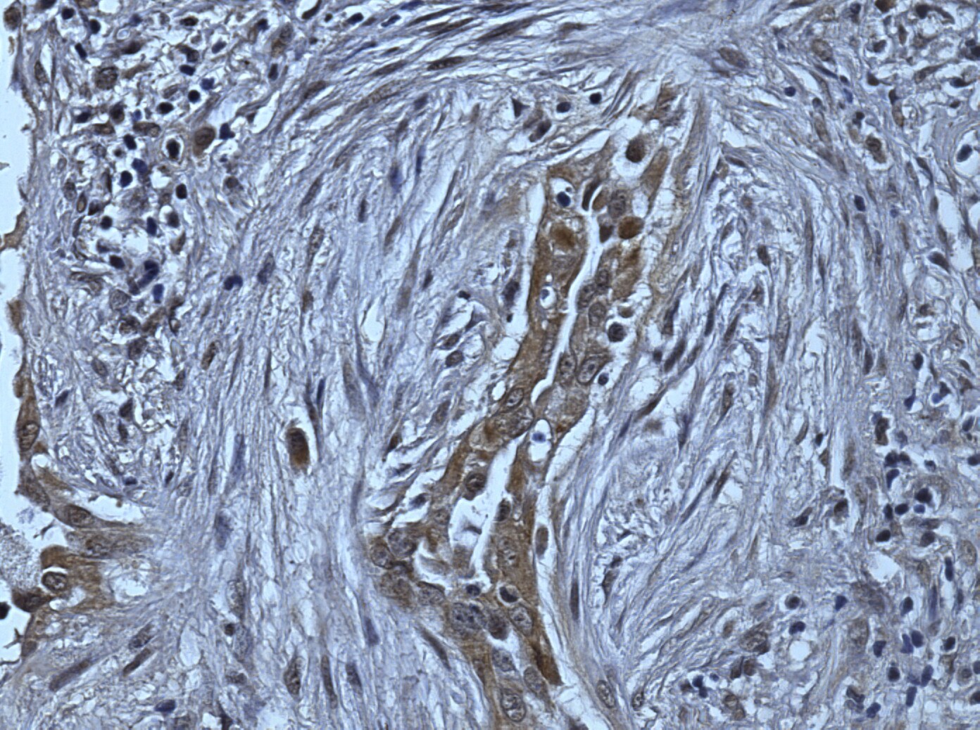 Human Desmocollin‑3 Antibody AF4630