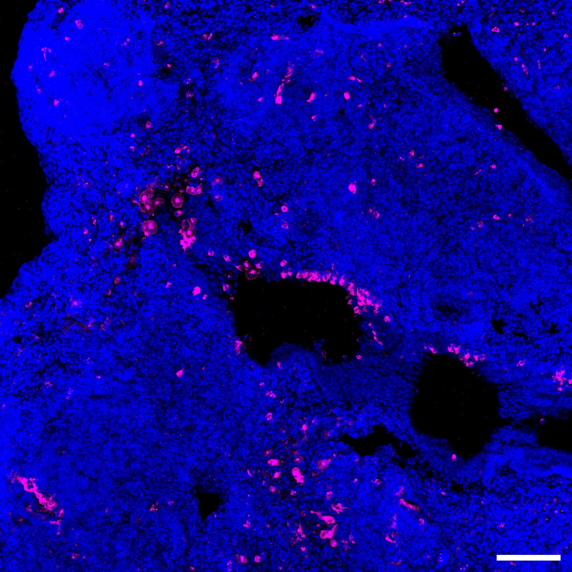 Mouse CCL9/10/MIP‑1 gamma  Antibody AF463