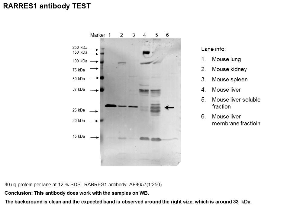 Mouse RARRES1 Antibody AF4657