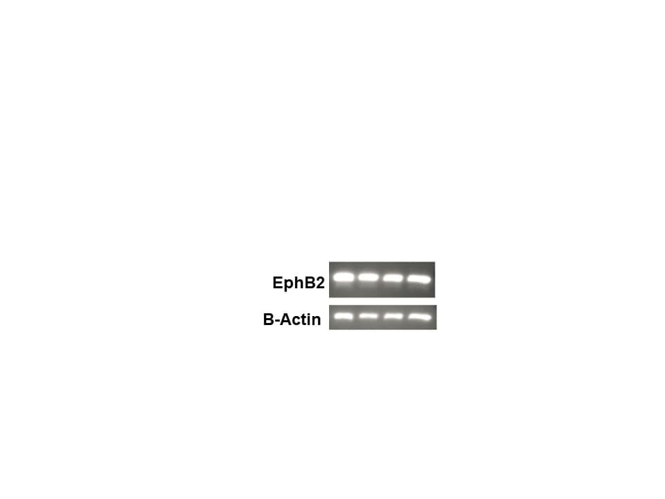 Human/Mouse EphB2 Antibody AF467