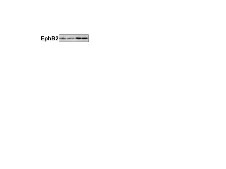 Human/Mouse EphB2 Antibody AF467