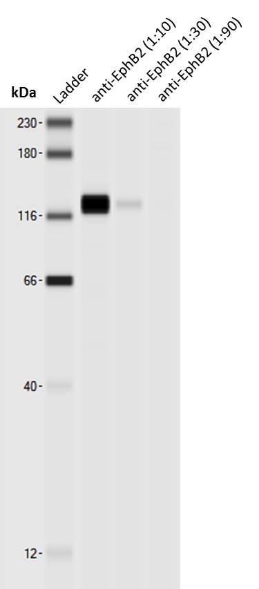 Human/Mouse EphB2 Antibody AF467