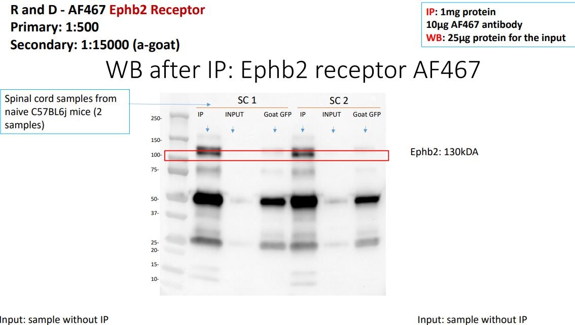 Human/Mouse EphB2 Antibody AF467