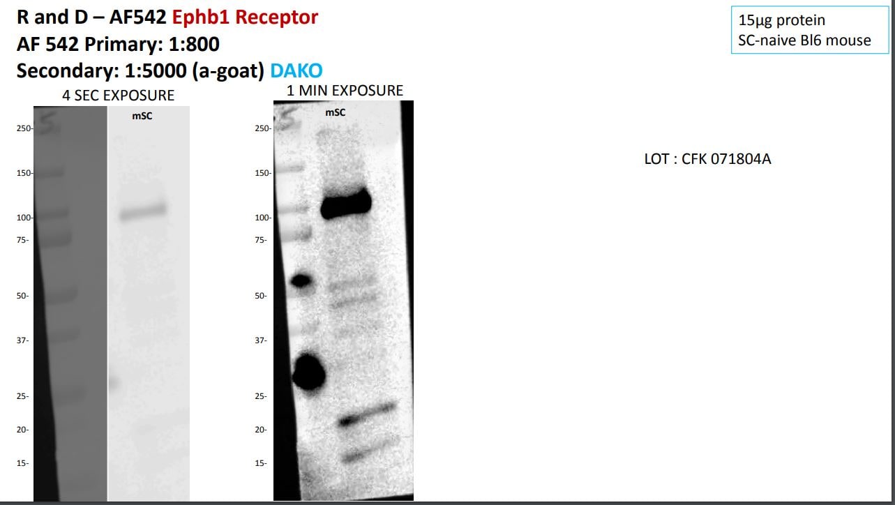 Human/Mouse EphB2 Antibody AF467
