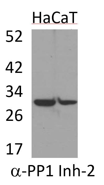 Human/Mouse/Rat PP1 Inhibitor‑2 Antibody AF4719
