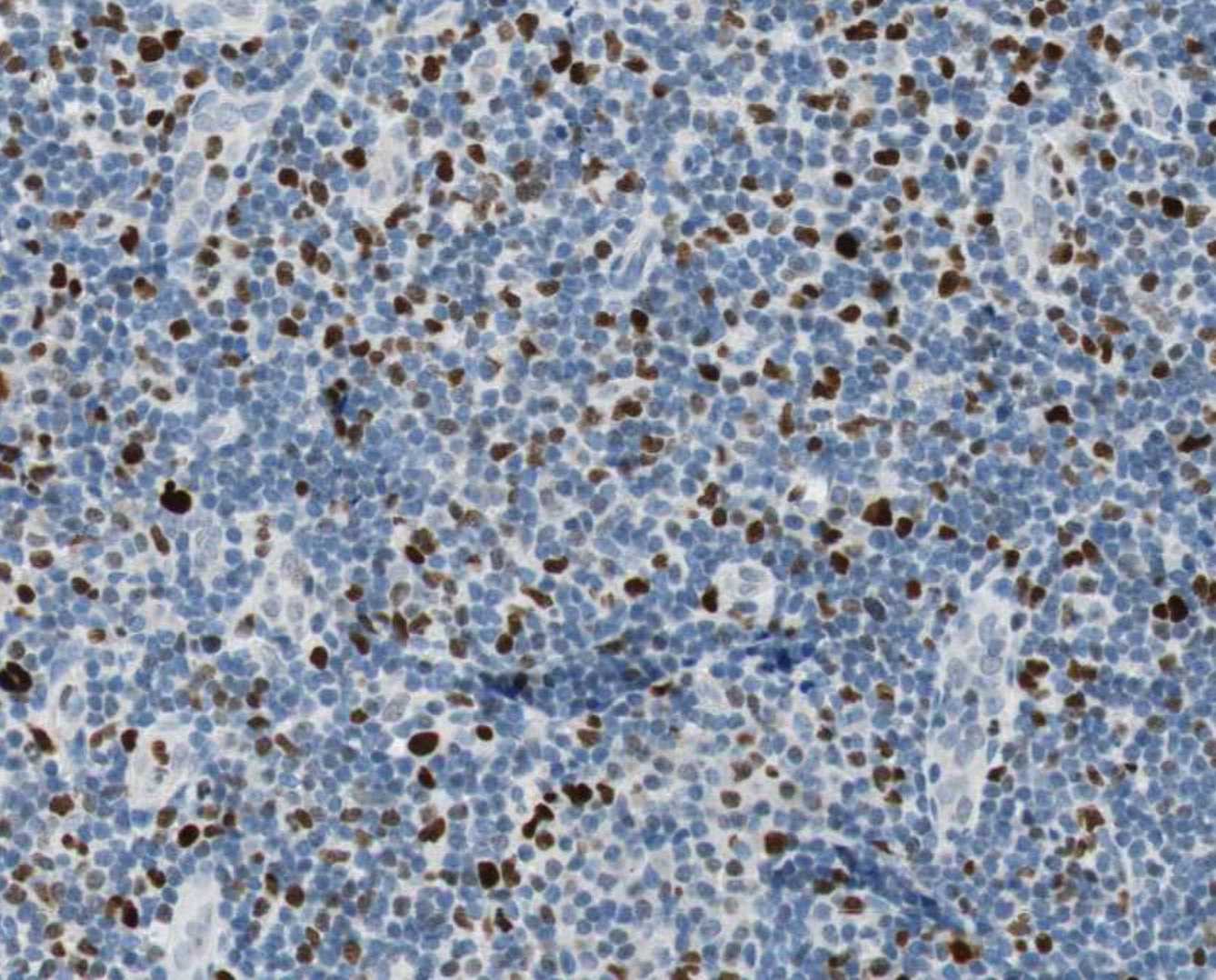 Human/Mouse EZH2 Antibody AF4767
