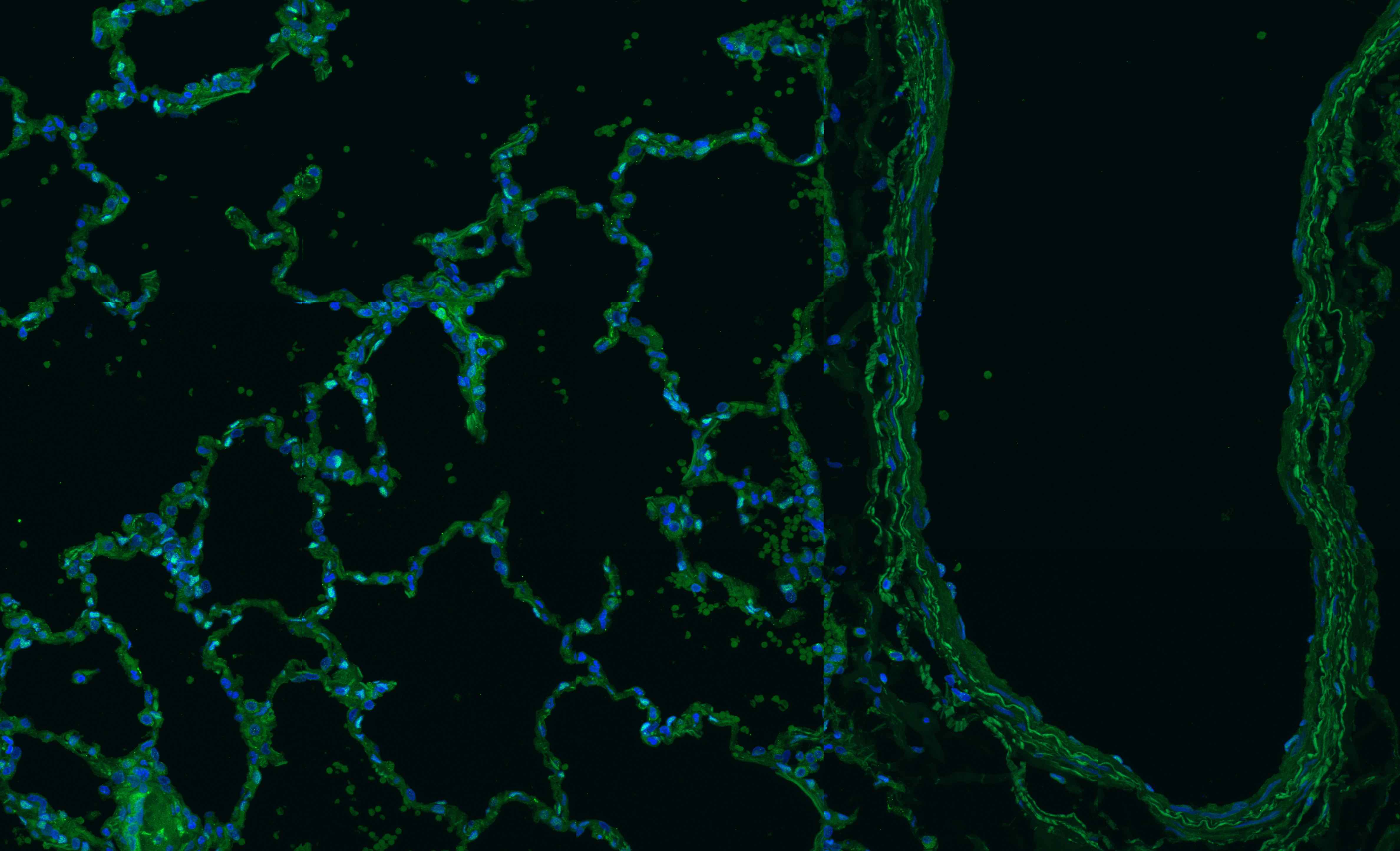 Human FoxF1 Antibody AF4798