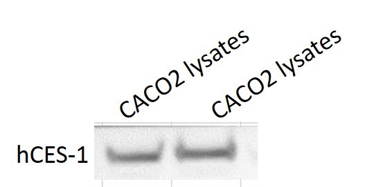 Human/Mouse/Rat Carboxylesterase 1/CES1 Antibody AF4920