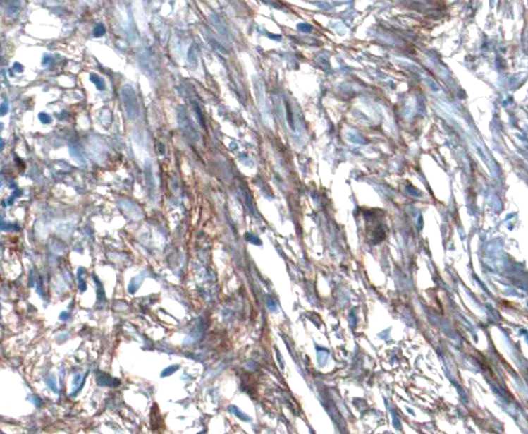 Human/Mouse LRRN1/NLRR‑1 Antibody AF4990