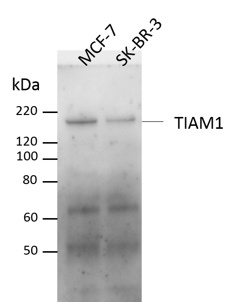 Human/Mouse TIAM1 Antibody AF5038