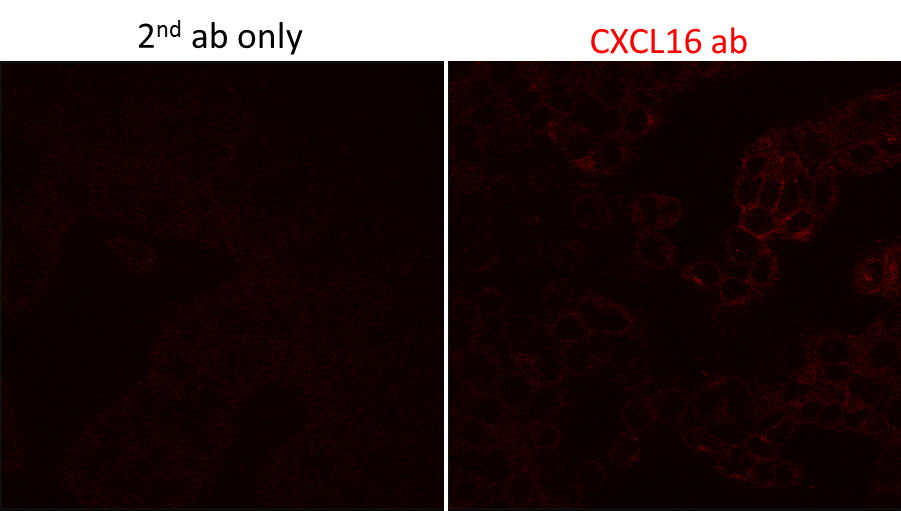 Mouse CXCL16 Antibody AF503