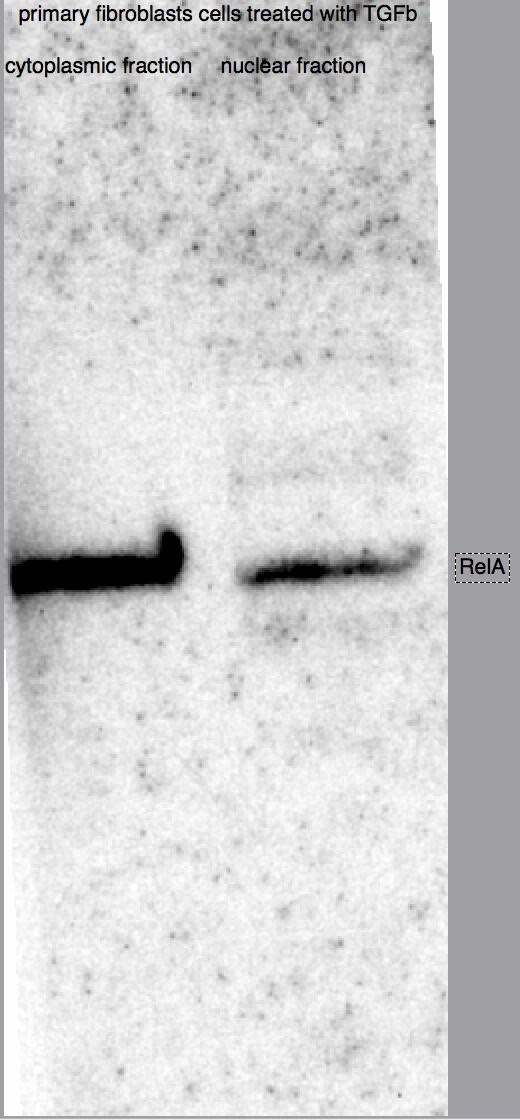 Human/Mouse/Rat RelA/NF kappa B p65 Antibody AF5078